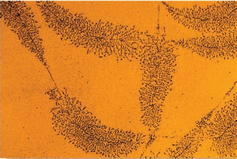 Under the electron microscope, DNA molecules undergoing  .